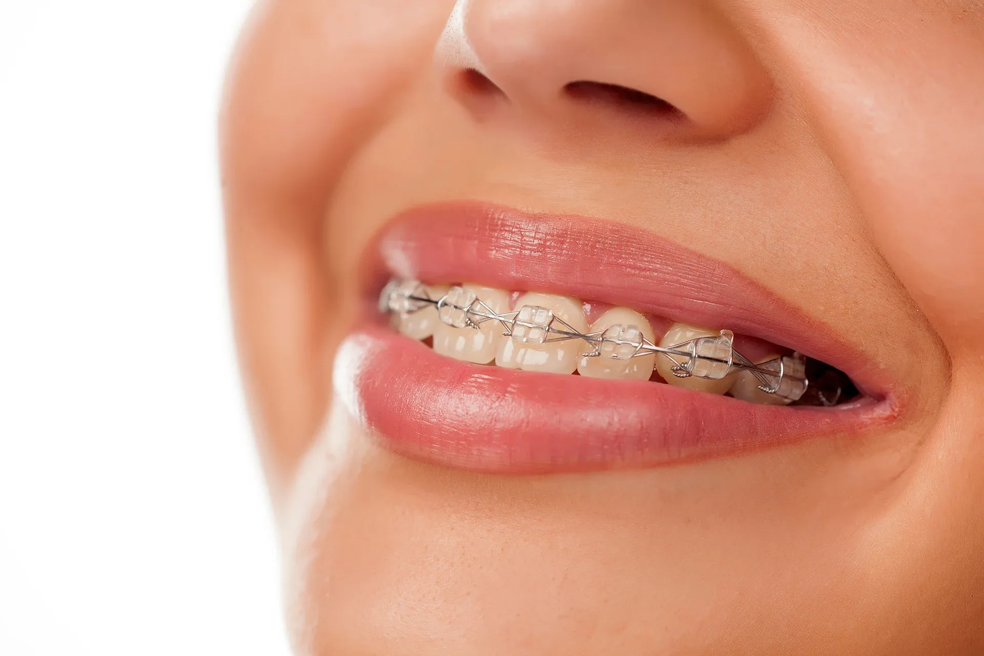 orthodontist in San Antonio, TX