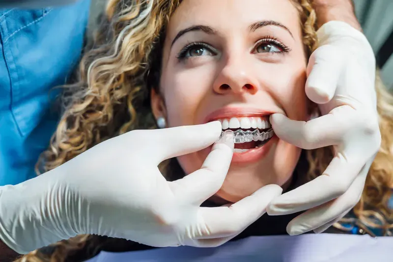 Lingual Braces vs. Clear Aligner Therapy