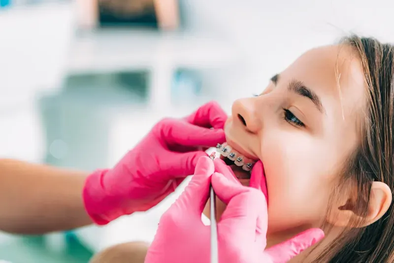 The Benefits of Early Interceptive Orthodontics