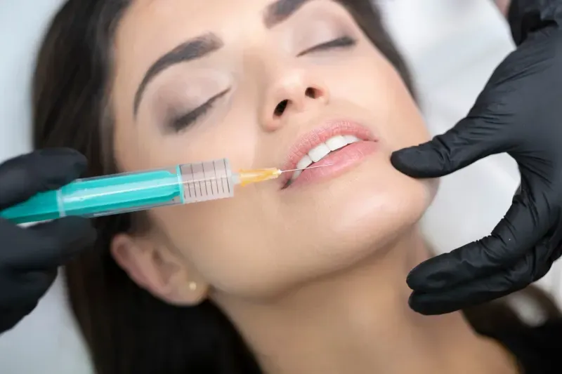 Dermal Fillers and Orthodontics