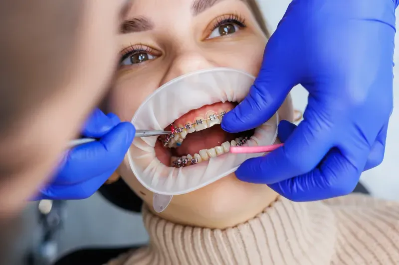 It’s Never Too Late to Improve Your Smile