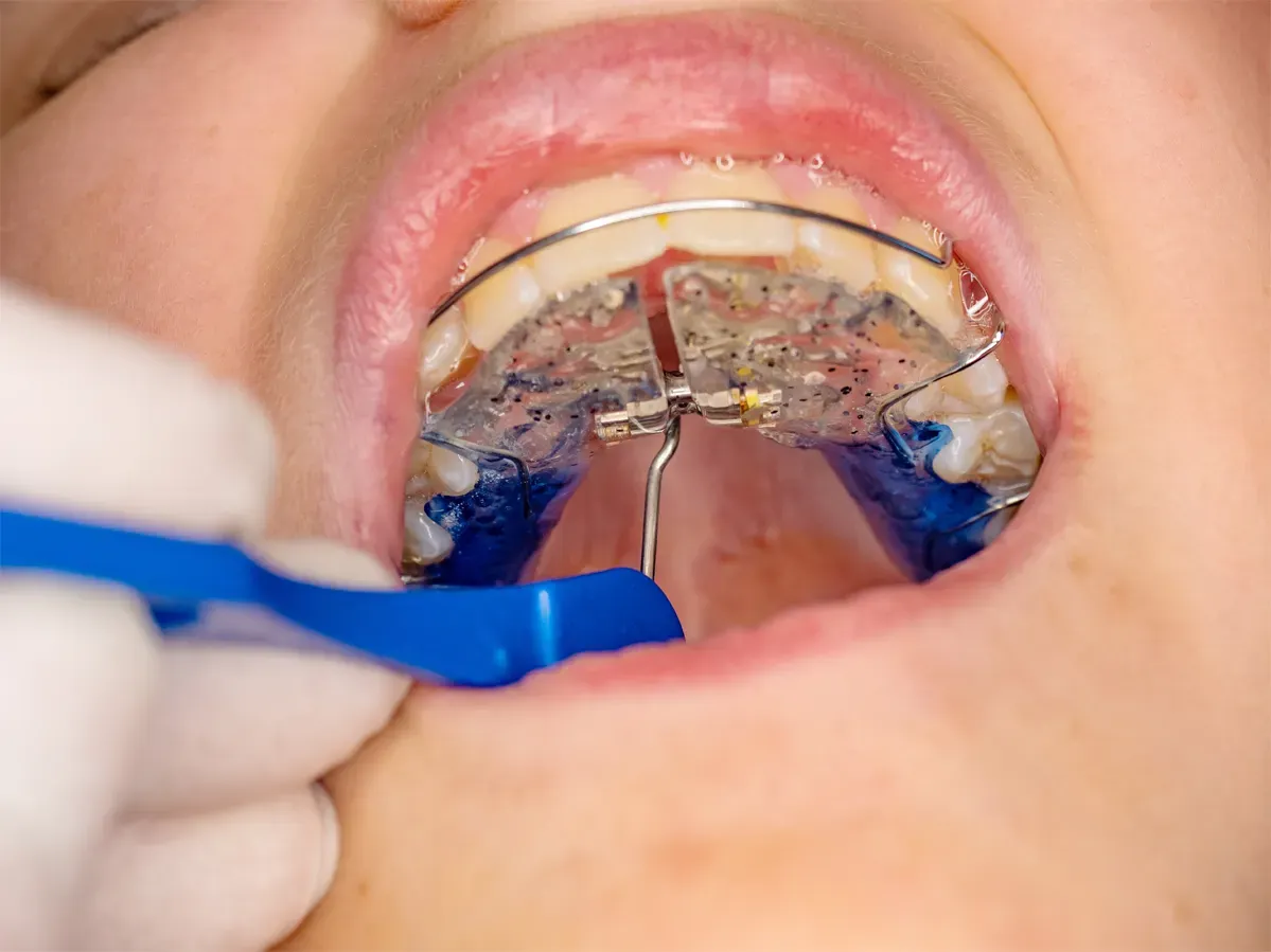 Orthodontics for All Ages - Orthodontist in San Antonio, TX