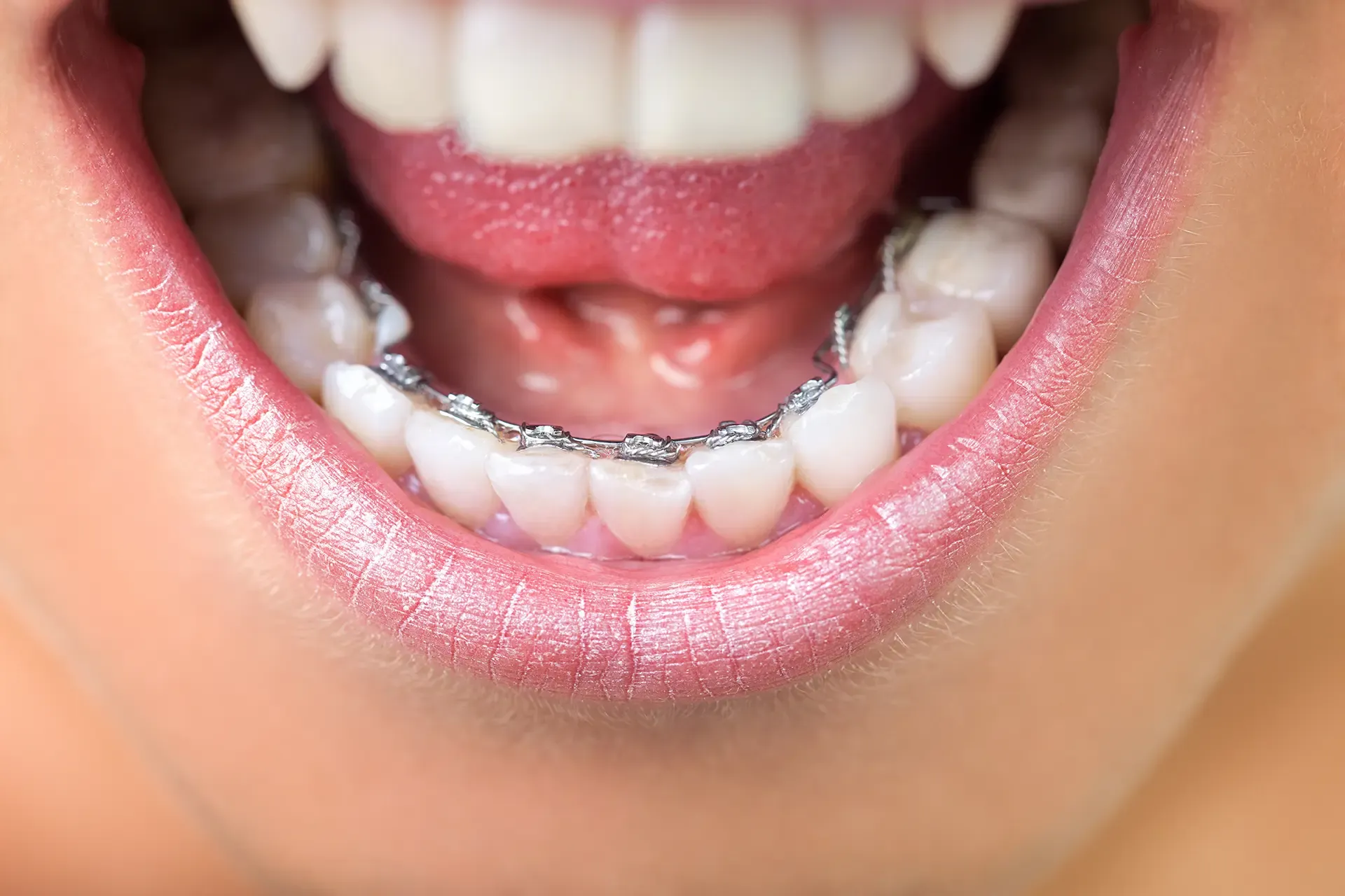 Customized Strategies for Alleviating Jaw Discomfort